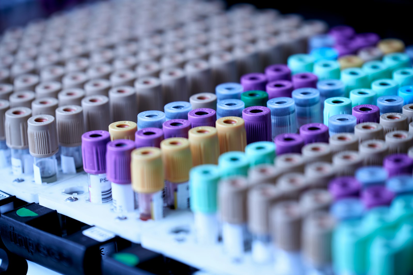 Blood collection tubes racked for laboratory testing
